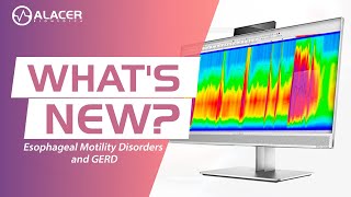 Esophageal Motility Disorders and GERD  Whats New  Full Live [upl. by Tat]