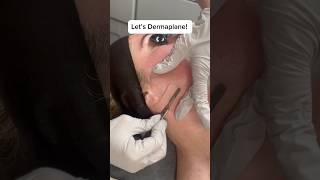 𝘉𝘺𝘦 𝘣𝘺𝘦 𝘥𝘦𝘢𝘥 𝘴𝘬𝘪𝘯  𝘱𝘦𝘢𝘤𝘩 𝘧𝘶𝘻𝘻 👋 dermaplaning facial antiaging skincare [upl. by Georgy]