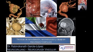 quotTÉCNICAS DE REMODELACIÓN RECONSTRUCCIÓN Y CLIPAJE EN ANEURISMAS CEREBRALES COMPLEJOSquot [upl. by Crenshaw]