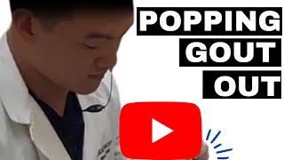 Popping gout out [upl. by Aikemet]