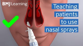 Teaching patients to use nasal sprays  BMJ Learning [upl. by Bresee174]