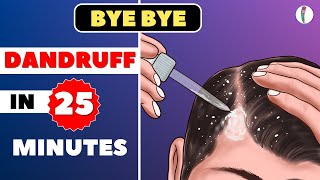 🔥1 Dandruff Treatment at Home  How to get rid of Dandruff  Dandruff Removal  Itchy scalp [upl. by Wiencke]