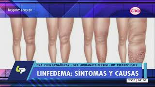 Linfedema qué es Medidas para prevenir y tratar el linfedema [upl. by Atinaj866]