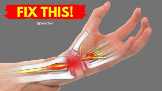 How to Fix Wrist Pain for Good [upl. by Sirapal]