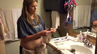 Ileostomy bag change Video 1 of 2 my phone died half way through lol [upl. by Enimzaj]