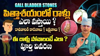 ఈ లక్షణాలు ఉంటే జాగ్రత్త  Dr Movva Srinivas About Gallbladder Stones Symptoms  Telugu Health Focus [upl. by Aerdua]