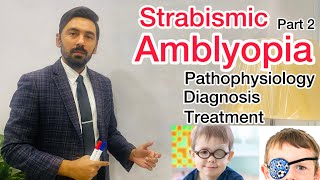 Strabismic Amblyopia  Pathophysiology  Diagnosis  Treatment [upl. by Anauqat]