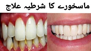 Mas khora ka ilaj aur iska manjan  How to get rid from pyorrhea  Tips In UrduHindi painrelief [upl. by Irollam]