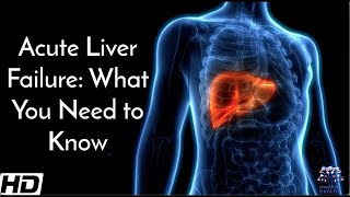 Acute Liver Failure What You Need To Know [upl. by Lenore124]