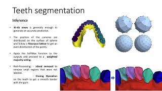 MICCAI 3DTeethSegChallenge  second place [upl. by Rochette]