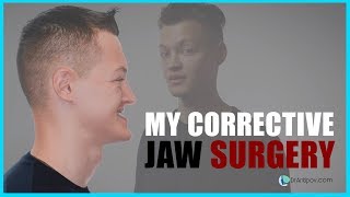 Orthognathic Jaw surgery 2019 before and After [upl. by Eelidnarb]