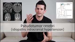 Pseudotumor cerebri idiopathic intracranial hypertension [upl. by Richter]