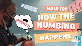 Explaining the Numbing process [upl. by Robbins]