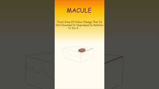 What is Macule Papule and Nodule  Common Oral Pathology Terms  Basic Viva Qs  shorts [upl. by Radburn519]