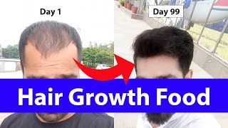 How to Regrow Hair in 99 Days [upl. by Hada]