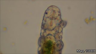 Water Bears under the microscope [upl. by Yllier988]