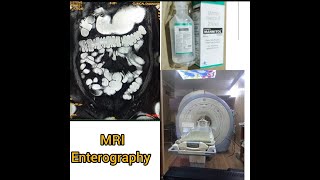 MRI Enterography planning and positioning on GE signa HDxt 15T [upl. by Ahseiat585]