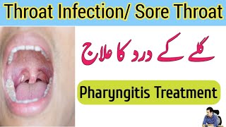 Throat Infection Treatment In Urdu Hindi  Throat Pain  Gale Ka Dard Kaise Thik Kare  Irfan Azeem [upl. by Iroc360]