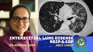 HRCT in ILD  NSIP amp COP  Dr Anagha Joshi [upl. by Eeluj]