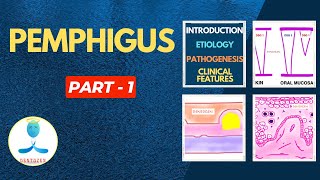 Pemphigus Part 1  Etiology Pathogenesis Pemphigus Vulgaris  Clinical features  Nikolskys Sign [upl. by Willett]