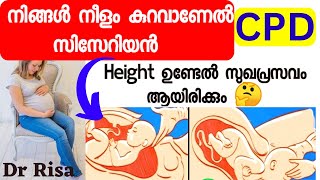 Reason For Cesarean MalayalamCPD In Pregnancy Height Affect Delivery [upl. by Enitsugua]