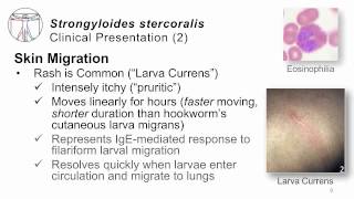 Helminths Strongyloides [upl. by Kaile]