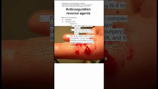 Anticoagulation reversal agents [upl. by Anagnos157]