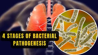 Bacterial Pathogenesis  4 Stages and Mechanism of Bacterial Pathogenesis [upl. by Arleta984]