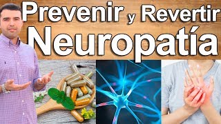 ELIMINE SU NEUROPATIA  Neuropatía Diabética y Periférica  Estilo de Vida Dieta y Suplementos [upl. by Sayres]