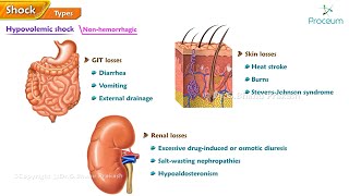 2Shock Hypovolumic Shock Cardiogenic Shock Obsructive Shock Distributive Shock [upl. by Llenram]