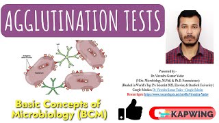 Agglutination tests I Immunology I Hemagglutination tests I Hemagglutination Inhibition tests I [upl. by Eveleen319]