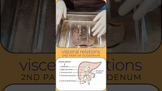 Second part of duodenum visceral relations relations of 2nd part of duodenum shorts duodenum [upl. by Ahsihat]