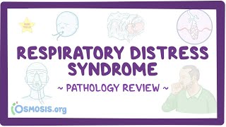 Respiratory distress syndrome Pathology Review [upl. by Eisaj817]