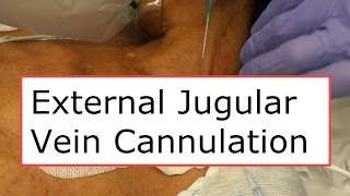 External Jugular Vein Cannulation [upl. by Leiand]