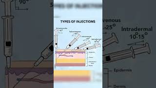 Injection Sites Of Degree  Injection Sites 💉💉📚🩺👨‍⚕️  shortvideo viralreels anatomy reels [upl. by Abdella]