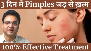 Pimples को बोलो अलविदा  4 Simple Steps To Remove Pimples amp Get Clear Spotless Skin Naturally [upl. by Simonne]