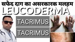 Tacrimus 01 ointment review। Tacrolimus ointment 01। for leucoderma। vitiligo। सफेद दाग। leprosy [upl. by Cuyler]