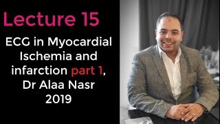 ECG from A to Z 015Alaa nasr2019myocardial ischemia and infarction part 1 [upl. by Higginbotham]