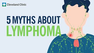 Debunking 5 Myths About Lymphoma [upl. by Ettennor]