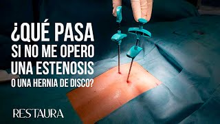 ¿Qué pasa si no me opero una estenosis o una hernia de disco [upl. by Hyacinthe]