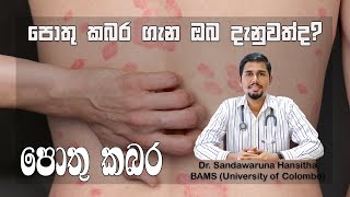 පොතු කබර Psoriasis [upl. by Illene103]