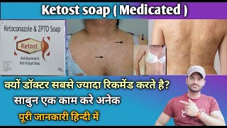 Ketost soap use benefits and Side effects full review in hindi [upl. by Duile587]