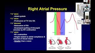 Hemodynamics Dr Aditi Singhvi [upl. by Aret]