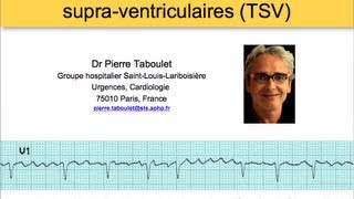 6a Classification des tachycardies supraventriculaires ECG Dr Taboulet [upl. by Nafri]