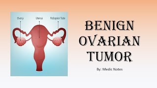 OampG Benign ovarian tumor  classification clinical features investigation treatment [upl. by Arva]