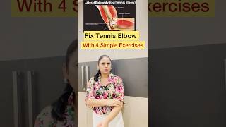 Fix Tennis Elbow At Home With 4 Simple Exercises shortsshortvideotenniselbowexercisepainrelief [upl. by Robert610]