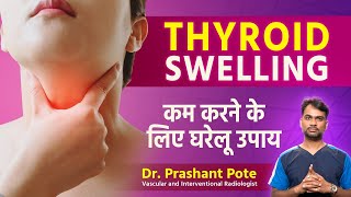 Managing Thyroid Swelling Naturally Diet Exercise and Stress Relief by Dr Prashant Pote [upl. by Nojed]