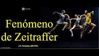 Fenómeno de Zeitraffer [upl. by Lanaj]