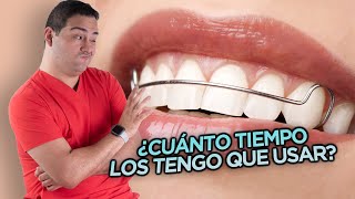 LOS RETENEDORES DESPUÉS DE LA ORTODONCIA  LOS DIENTES SIEMPRE SE VAN A MOVER LUEGO DE LOS BRACKETS [upl. by Nosnorb]