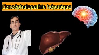 lencéphalopathie hépatique [upl. by Hilar]